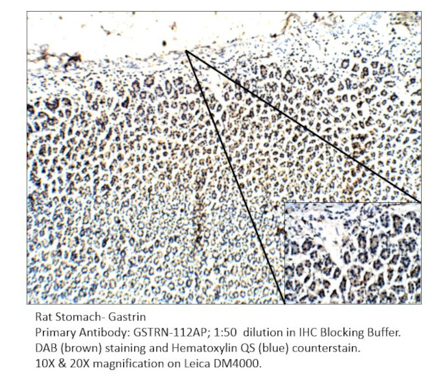 Gastrin Antibody in Immunohistochemistry (IHC)