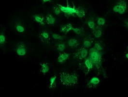 GSTT2 Antibody in Immunocytochemistry (ICC/IF)