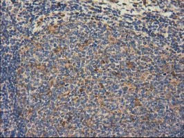 GSTT2 Antibody in Immunohistochemistry (Paraffin) (IHC (P))