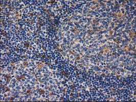 GSTT2 Antibody in Immunohistochemistry (Paraffin) (IHC (P))