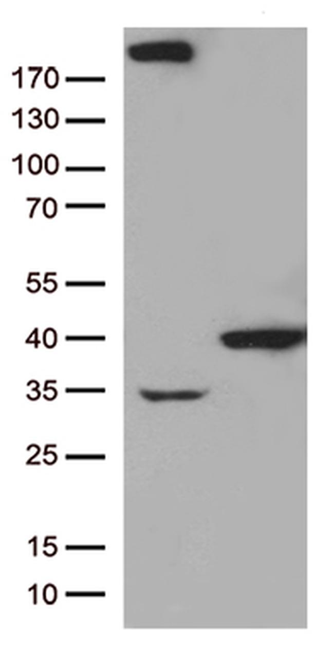 GTF2H3 Antibody in Western Blot (WB)