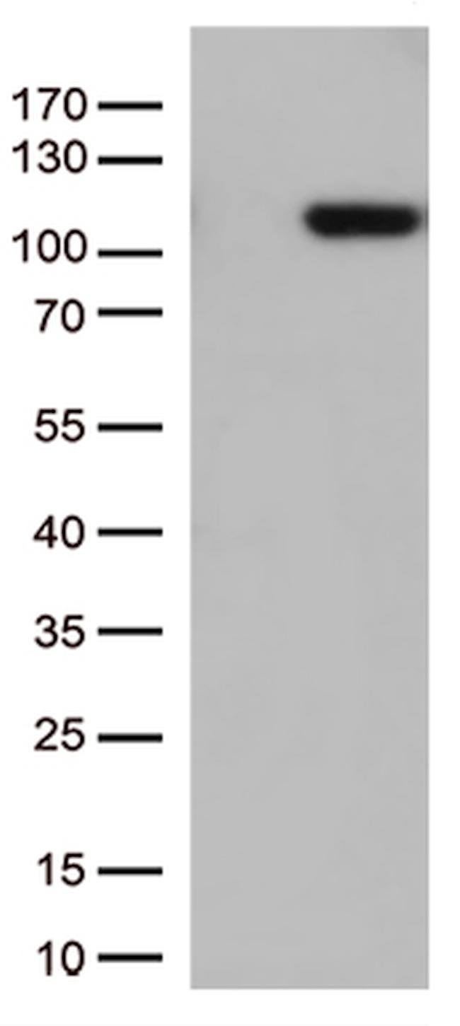 GTF3C4 Antibody in Western Blot (WB)