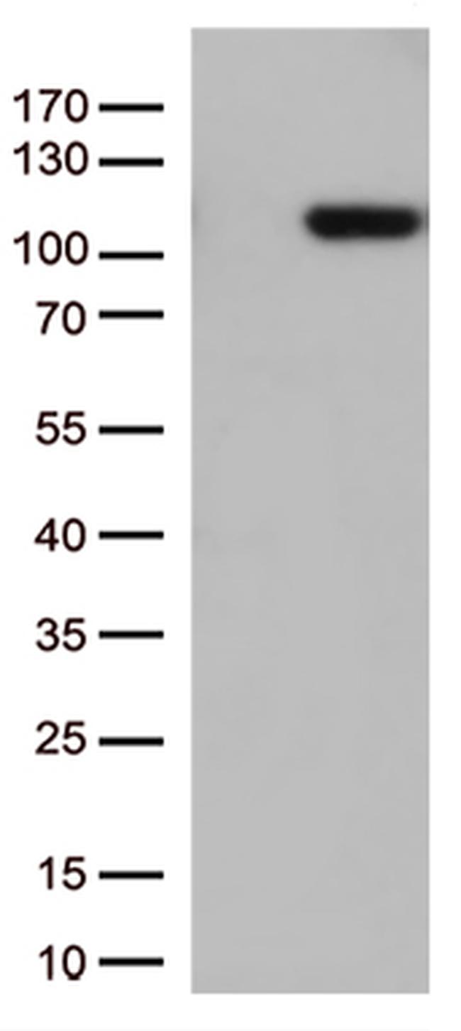 GTF3C4 Antibody in Western Blot (WB)