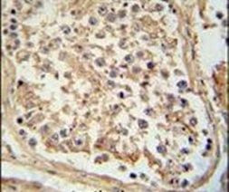 GTPBP2 Antibody in Immunohistochemistry (IHC)