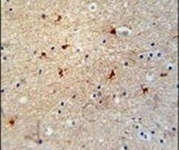 GTPBP8 Antibody in Immunohistochemistry (IHC)
