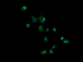 GZMB Antibody in Immunocytochemistry (ICC/IF)