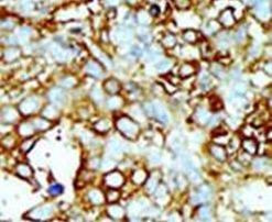 MAP4K2 Antibody in Immunohistochemistry (IHC)