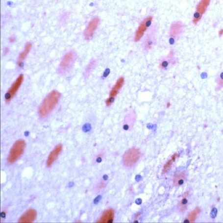 GluR6/GluR7 Antibody in Immunohistochemistry (IHC)