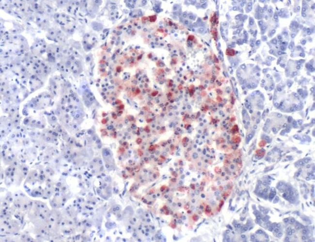 Glucagon Antibody in Immunohistochemistry (IHC)