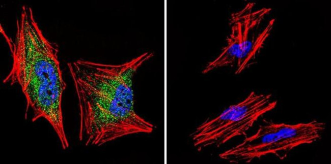 Glucocorticoid Receptor alpha Antibody in Immunocytochemistry (ICC/IF)