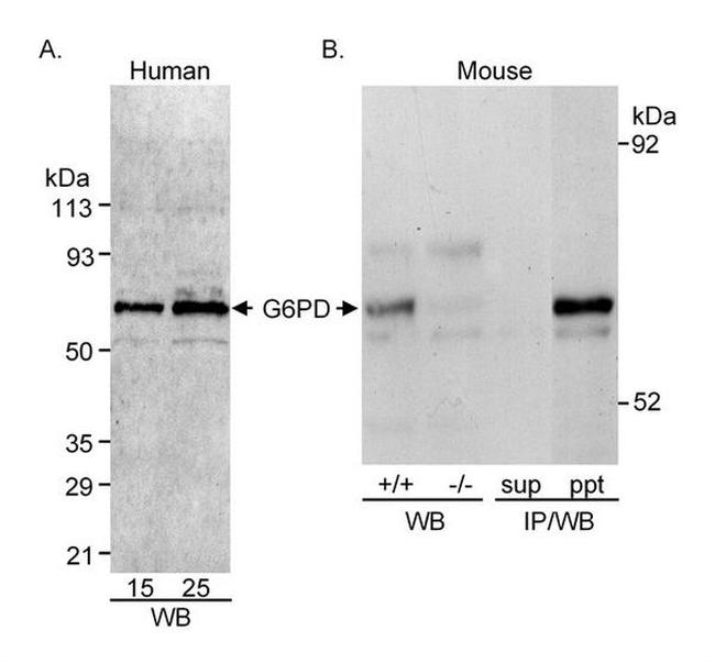 Glucose-6-Phosphate Dehydrogenase Antibody in Western Blot (WB)