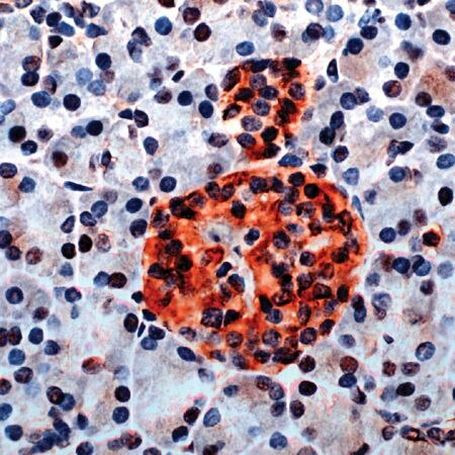 GAD65 Antibody in Immunohistochemistry (IHC)