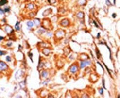 GK2 Antibody in Immunohistochemistry (IHC)