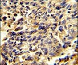 Glypican 1 Antibody in Immunohistochemistry (IHC)