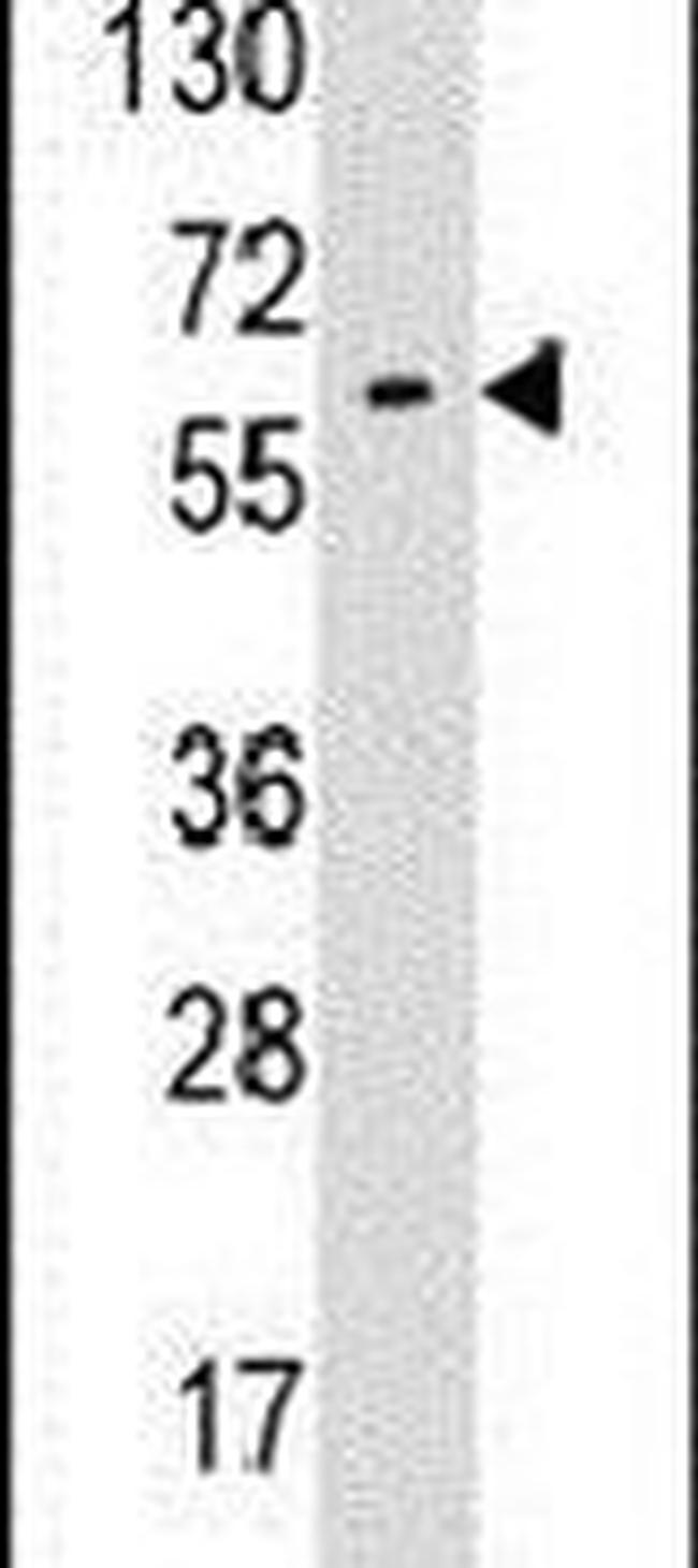 Glypican 6 Antibody in Western Blot (WB)