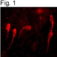 GnRH1 Antibody in Immunohistochemistry (IHC)