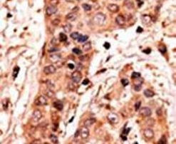 GUCY1A2 Antibody in Immunohistochemistry (IHC)