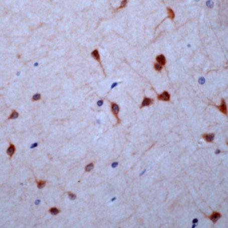 GUCY1B3 (soluble) Antibody in Immunohistochemistry (IHC)