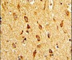 H-cadherin Antibody in Immunohistochemistry (IHC)