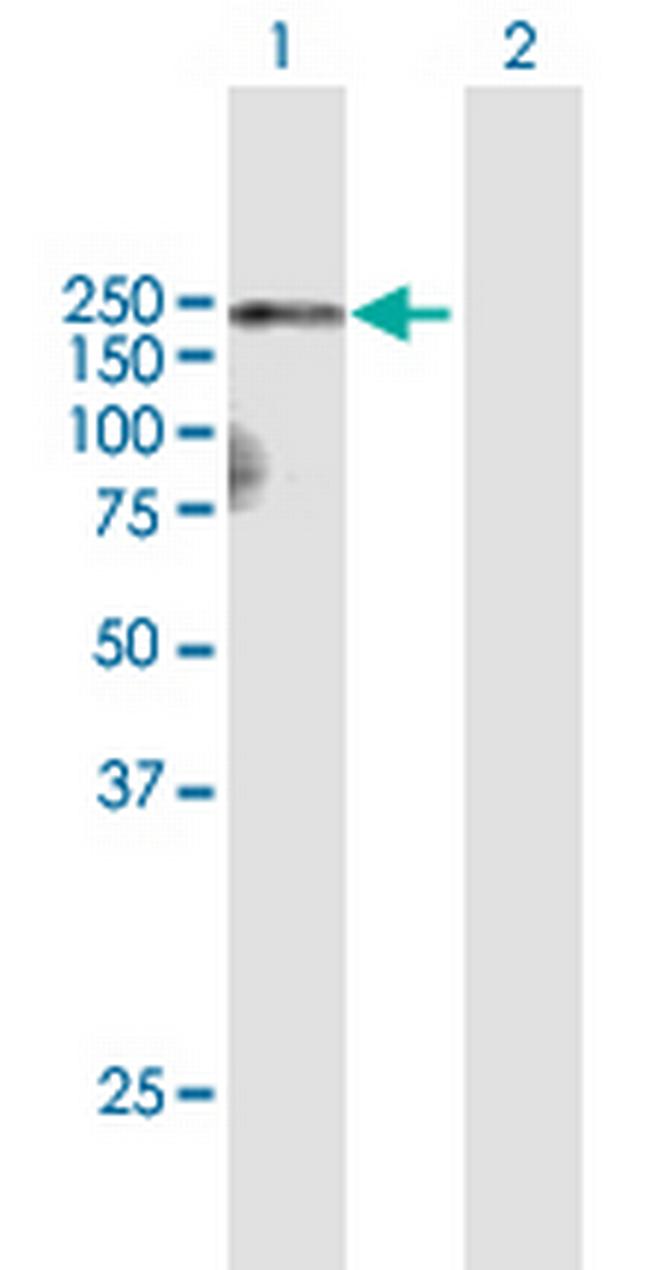 A2M Antibody in Western Blot (WB)
