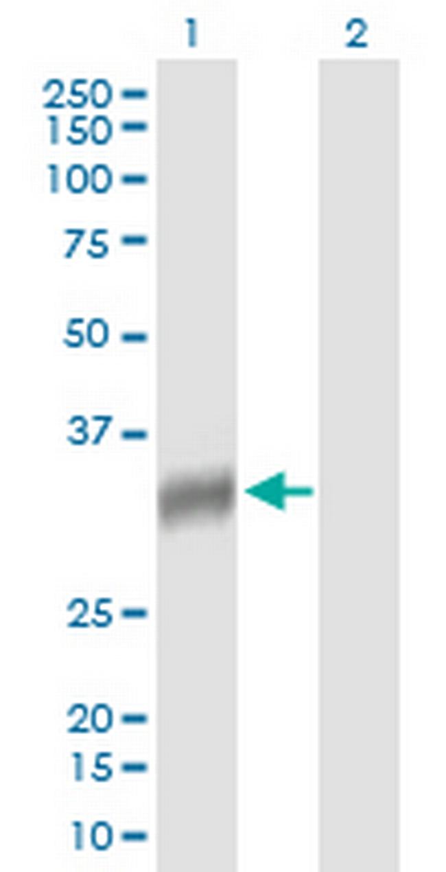 NAT2 Antibody in Western Blot (WB)