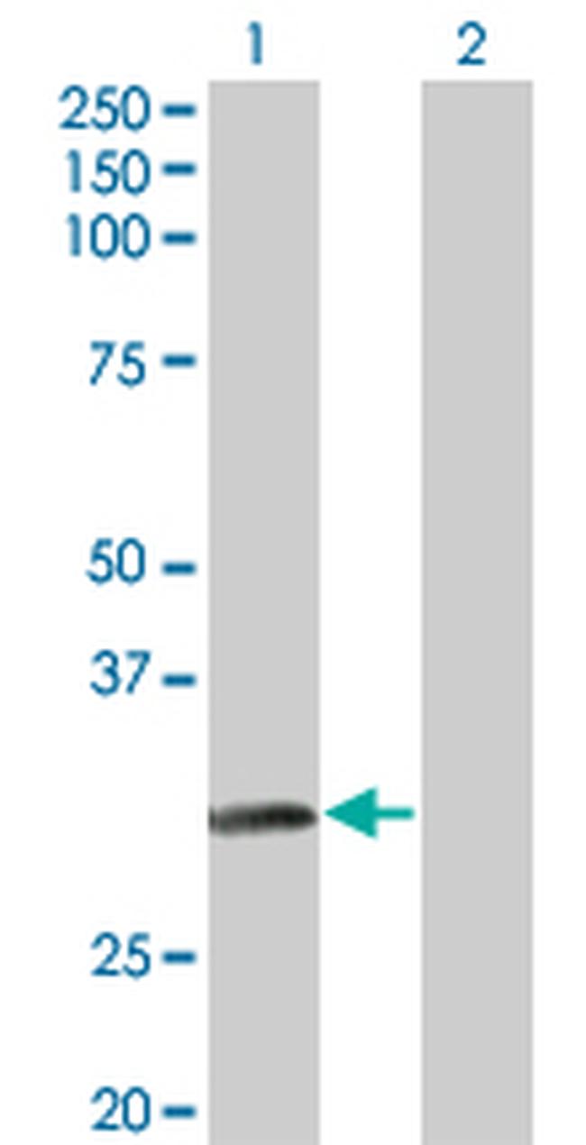 NAT2 Antibody in Western Blot (WB)