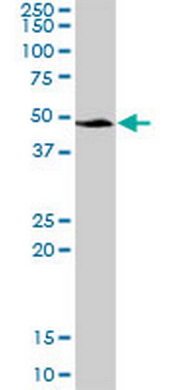 SERPINA3 Antibody in Western Blot (WB)