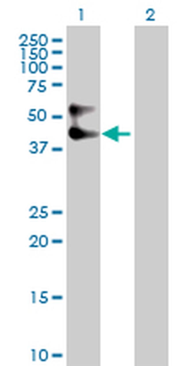 SERPINA3 Antibody in Western Blot (WB)