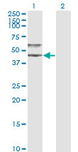 SERPINA3 Antibody in Western Blot (WB)