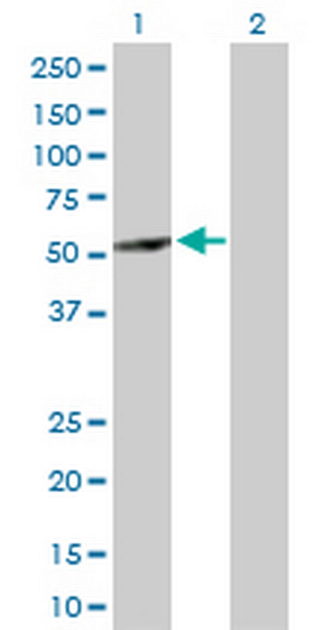 ABAT Antibody in Western Blot (WB)