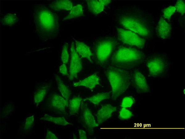 ABL2 Antibody in Immunocytochemistry (ICC/IF)