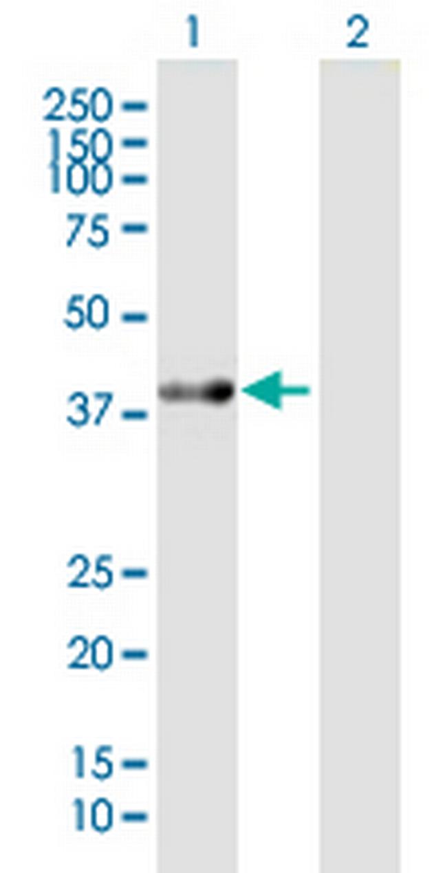 ACAT2 Antibody in Western Blot (WB)