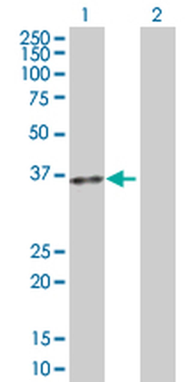 ACP5 Antibody in Western Blot (WB)