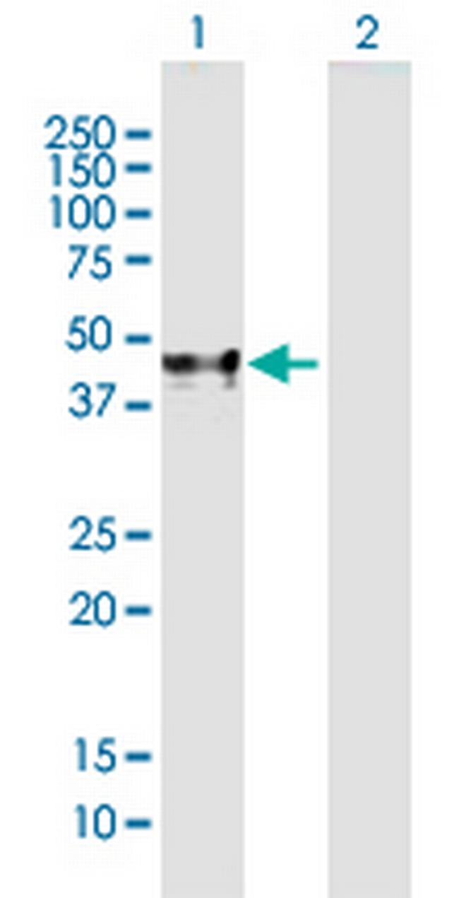 ACPP Antibody in Western Blot (WB)