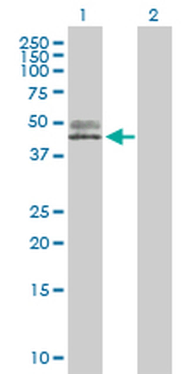 ACPP Antibody in Western Blot (WB)