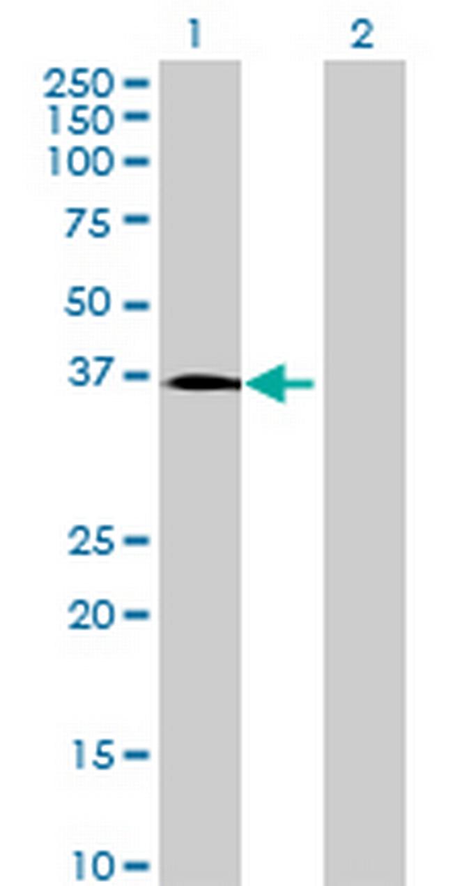 ACRV1 Antibody in Western Blot (WB)