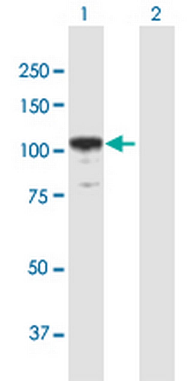ACTN2 Antibody in Western Blot (WB)