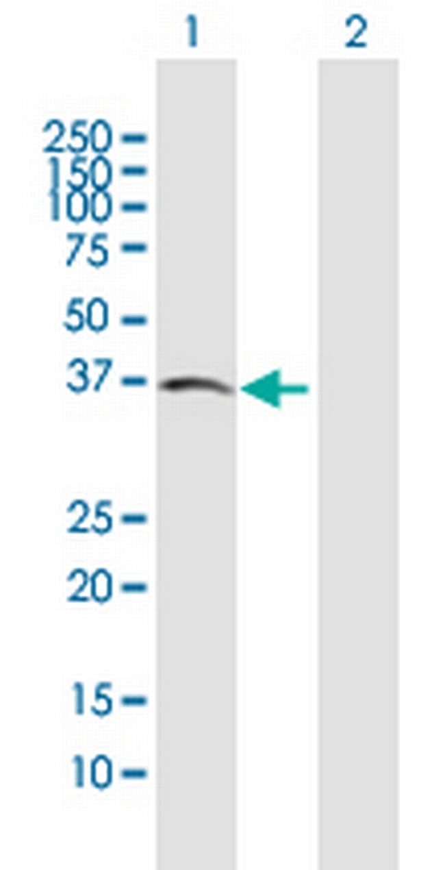ACVR2B Antibody in Western Blot (WB)