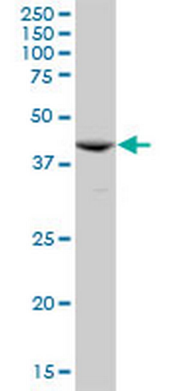 ACY1 Antibody in Western Blot (WB)
