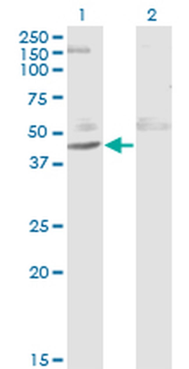 ACY1 Antibody in Western Blot (WB)