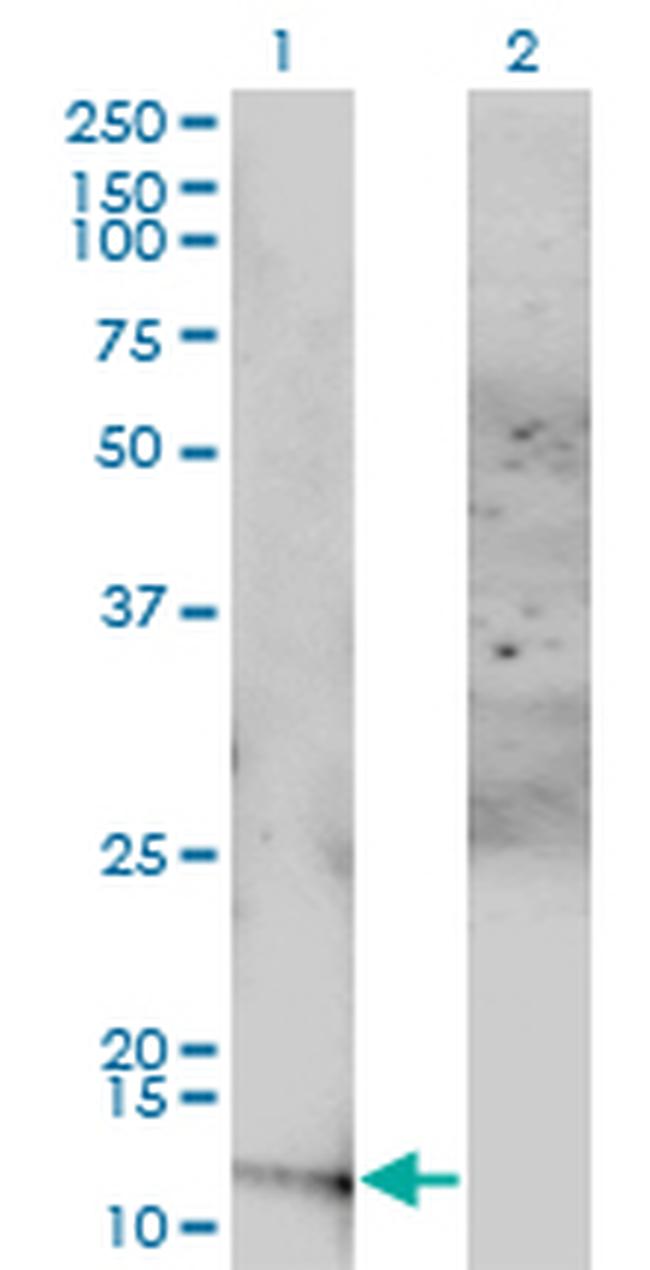 ACYP1 Antibody in Western Blot (WB)