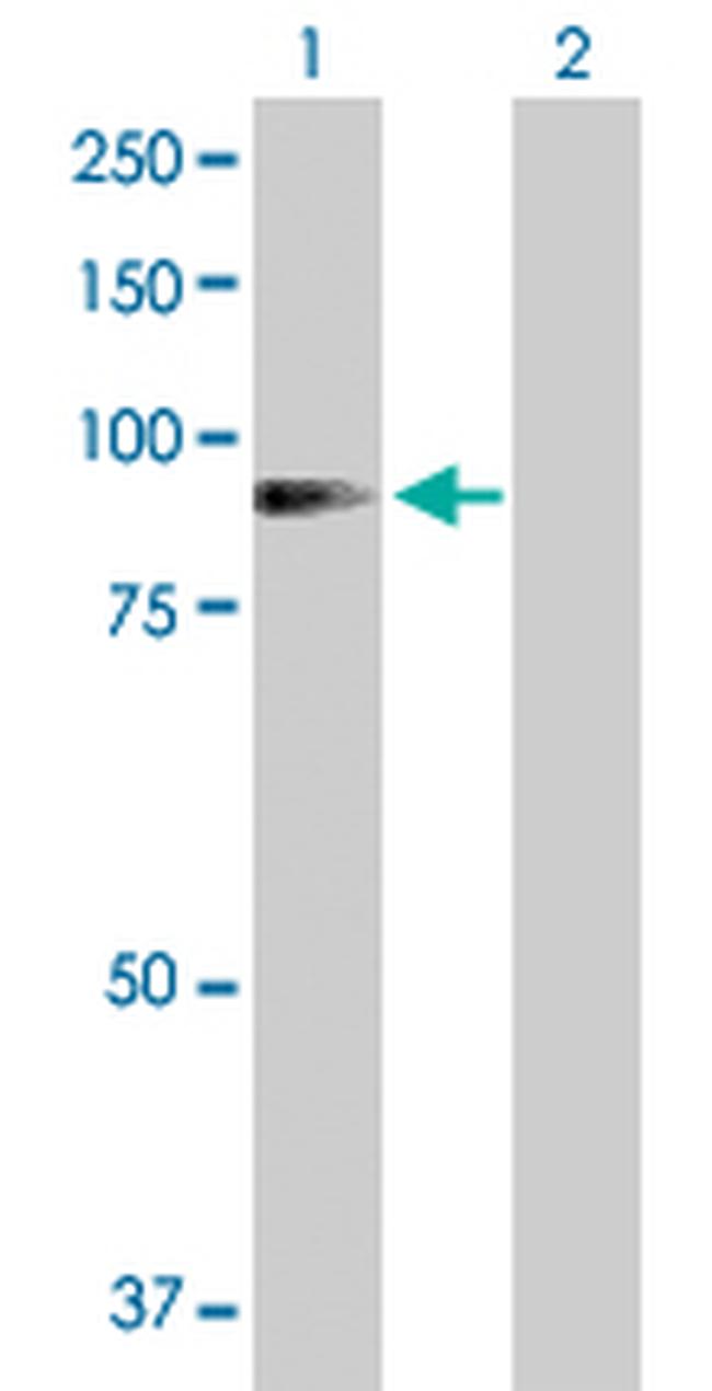 ADD1 Antibody in Western Blot (WB)