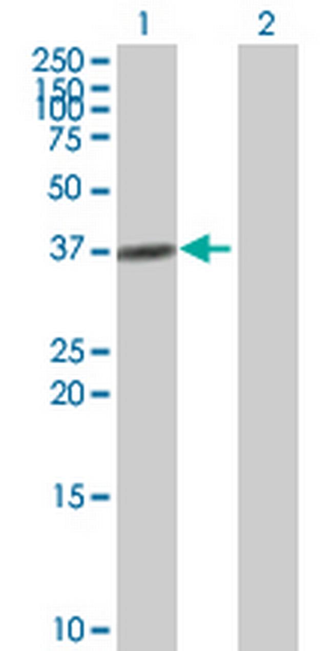 ADH4 Antibody in Western Blot (WB)