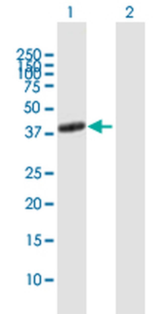 ADORA2A Antibody in Western Blot (WB)