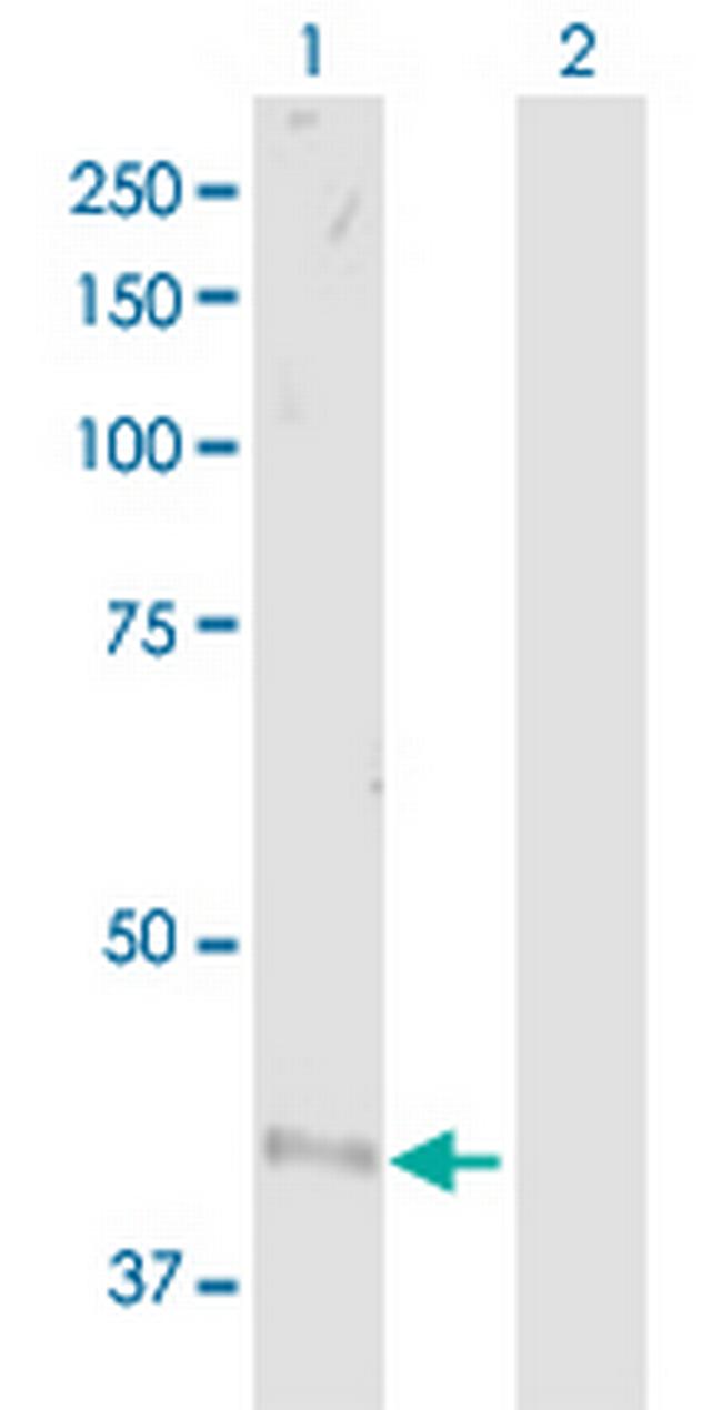 ADRB2 Antibody in Western Blot (WB)