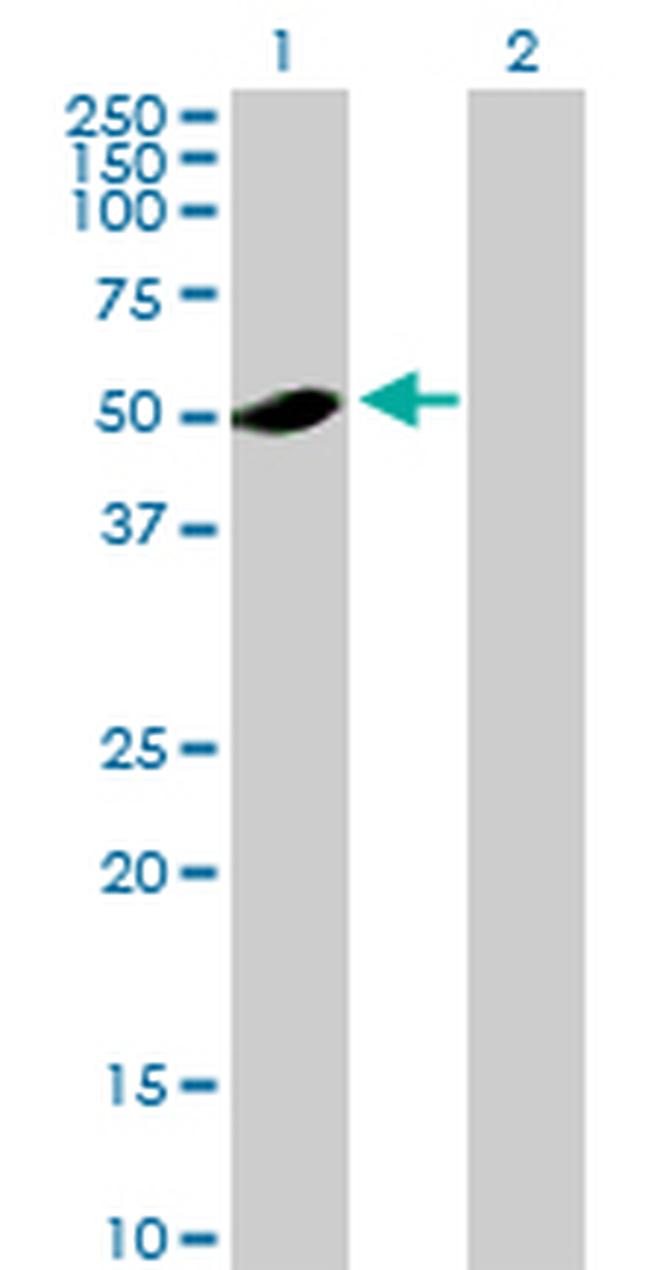 ADSL Antibody in Western Blot (WB)