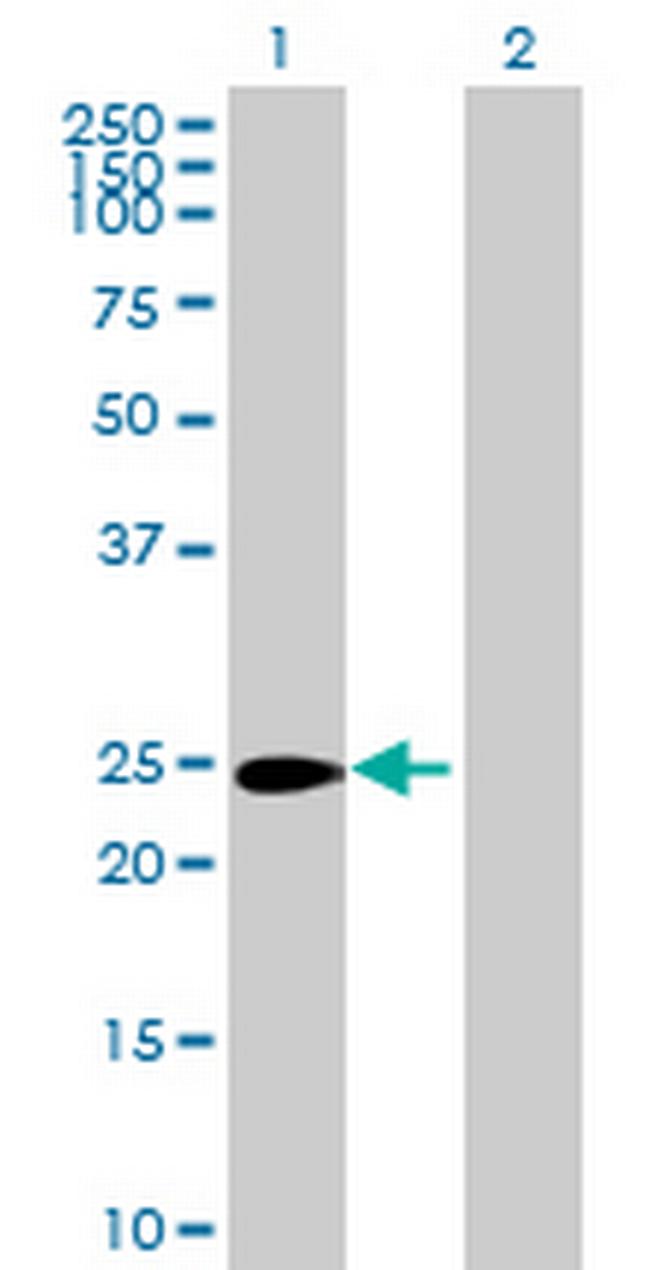 CRISP1 Antibody in Western Blot (WB)