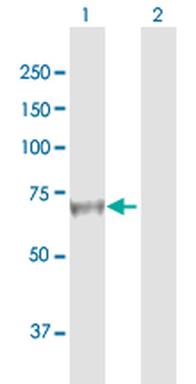 AFP Antibody in Western Blot (WB)