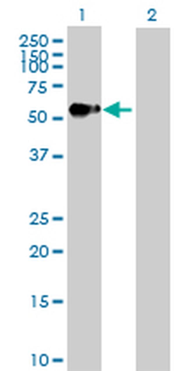 AGER Antibody in Western Blot (WB)