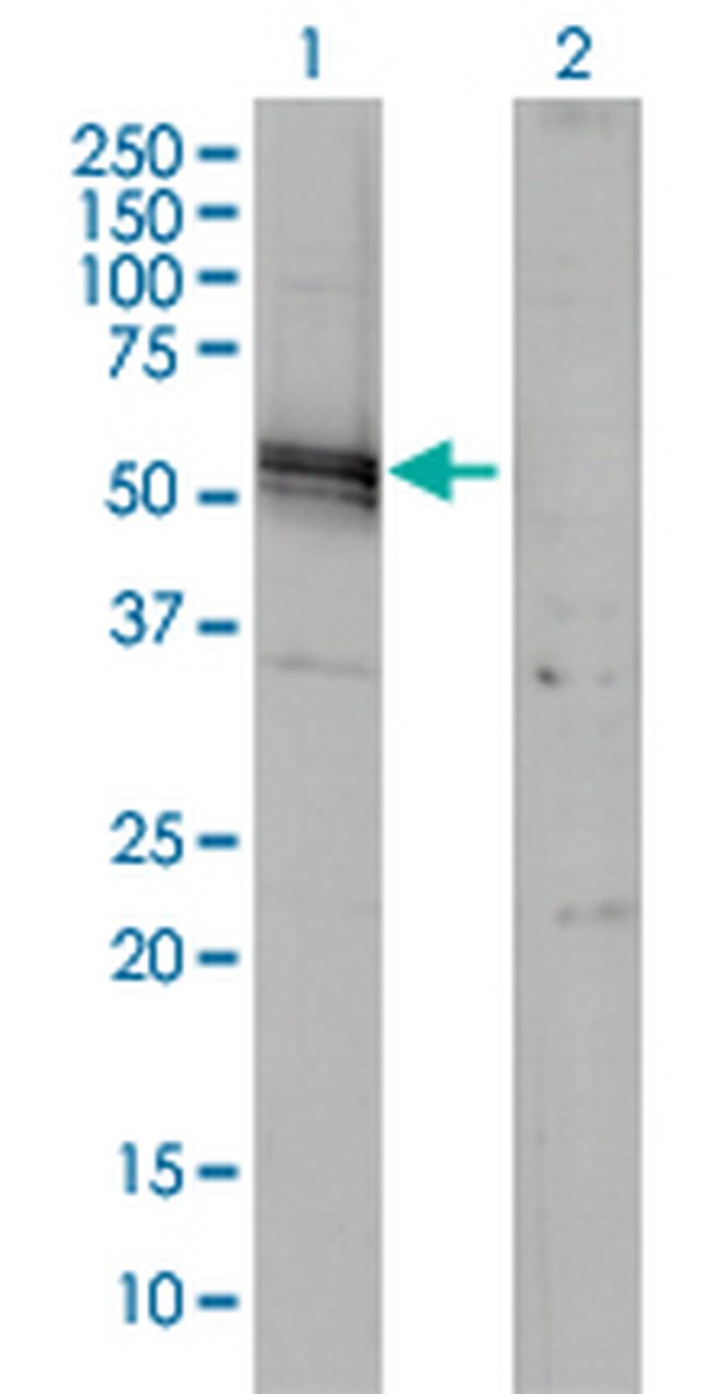 AGT Antibody in Western Blot (WB)